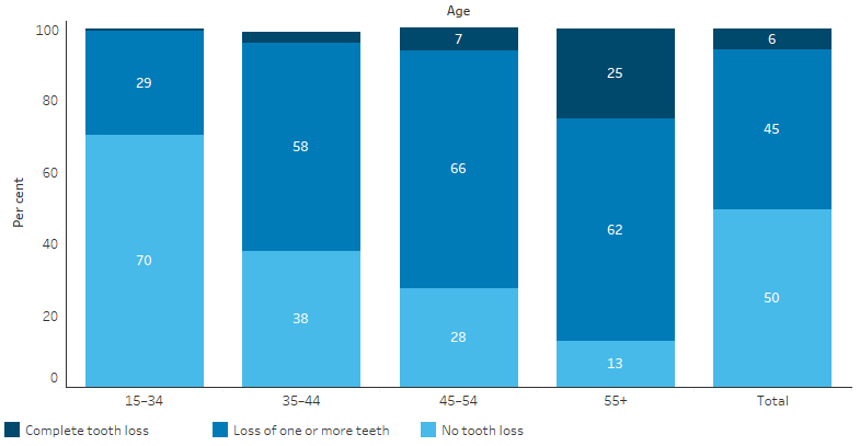 This stacked bar chart shows that overall, 45% of Indigenous Australians over the age of 15 had lost one or more teeth and 6% had complete tooth loss. For people aged 55 and over, 62% had lost one or more teeth, and 25% had complete tooth loss.